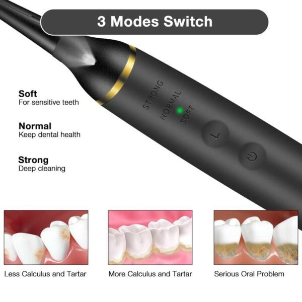 SKY POWER Ultrasonik Taşınabilir Diş Taşı Diş Lekesi Tartar Temizleyici - Görsel 4